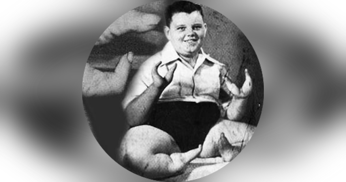 62. Lobster Boy - Grady Stiles, Jr. 62. Lobster Boy - Grady Stiles, Jr.