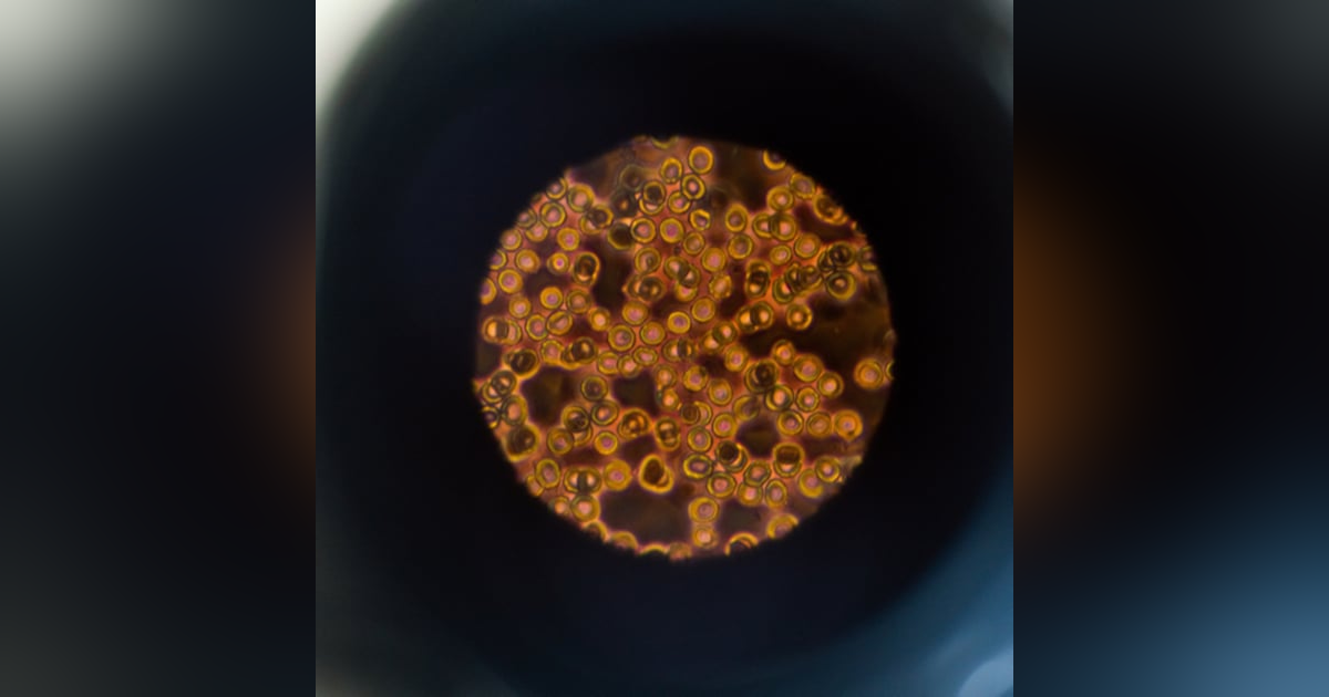 VV Clinical: A practical guide to diagnosing coagulopathy, Part 1. VV Clinical: A practical guide to diagnosing coagulopathy, Part 1.