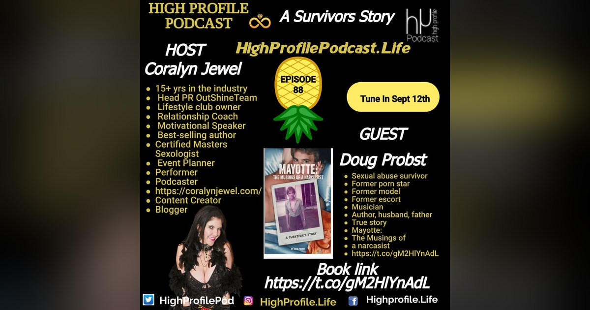 A true Story of Survival: Interview with Doug Probst: Sexual Assault Survivor, Musician, Former Model, escort and pornstar A true Story of Survival: Interview with Doug Probst: Sexual Assault Survivor, Musician, Former Model, escort and pornstar
