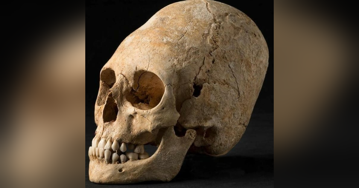 Elongated Skulls: Human or Alien Elongated Skulls: Human or Alien