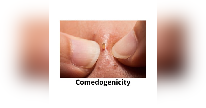 image for Comedogenicity Explained