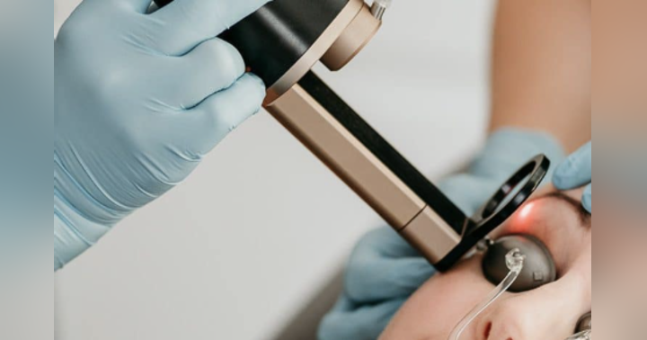 image for Lighting Up Your Skin: My Experience with the Alma Hybrid Laser with Dr. James Wang