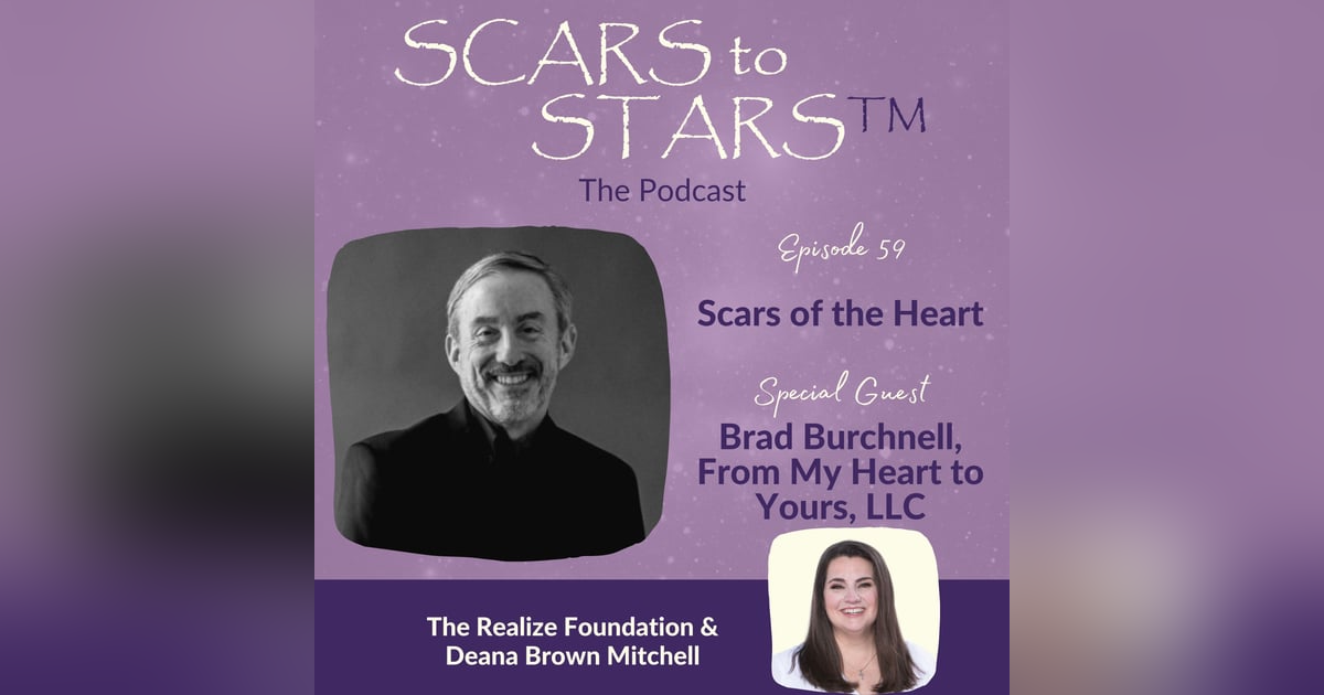 Scars of the Heart | Brad Burchnell Scars of the Heart | Brad Burchnell