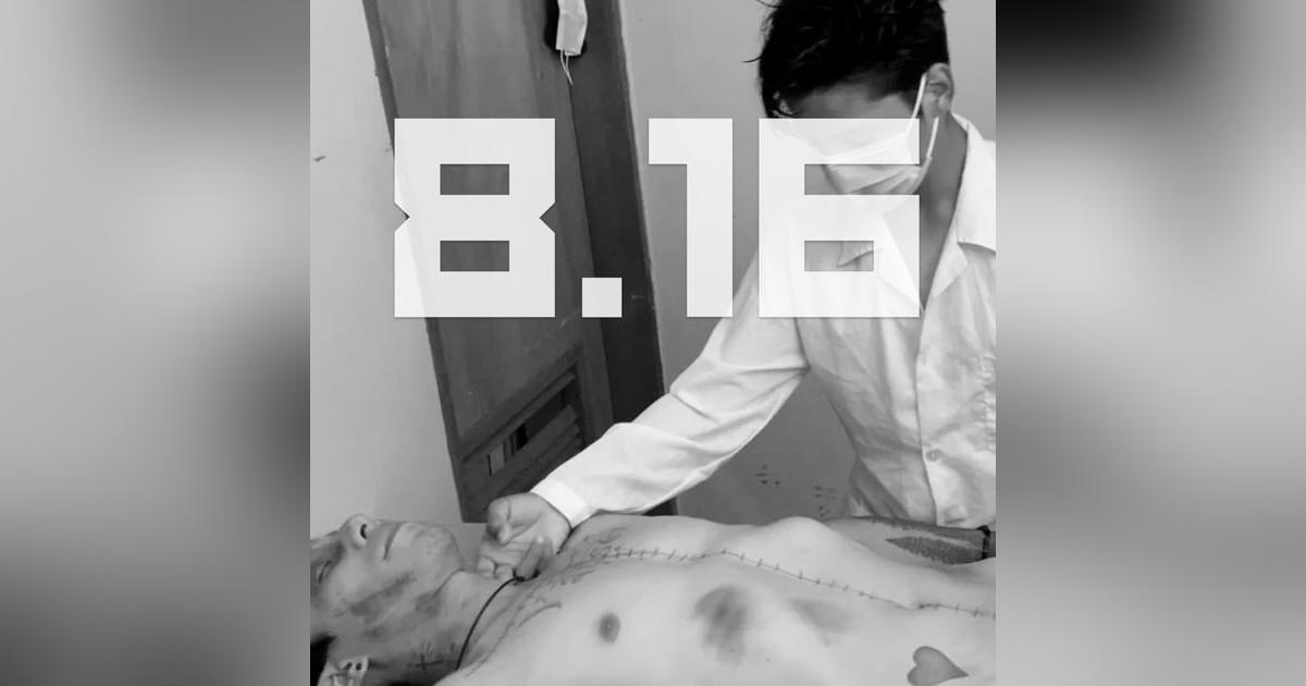 S8E16 - Zombies AmongUs | premature burials & lazarus syndrome S8E16 - Zombies AmongUs | premature burials & lazarus syndrome