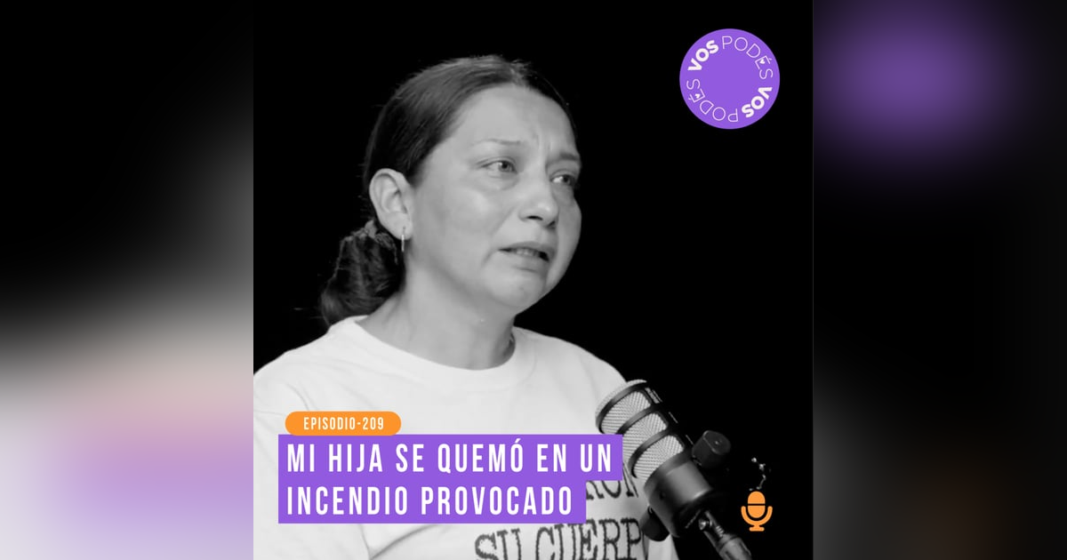 Mi hija se quemó en un incendio provocado: Invitada - Johana Maya Mi hija se quemó en un incendio provocado: Invitada - Johana Maya