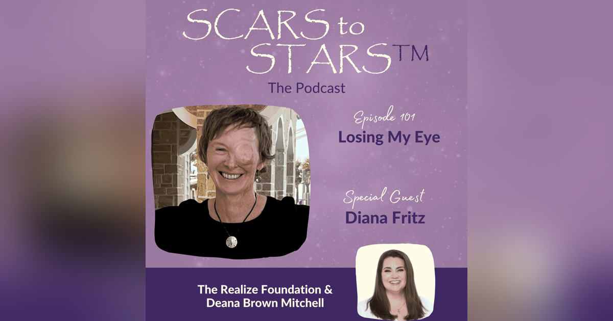 Losing My Eye Losing My Eye