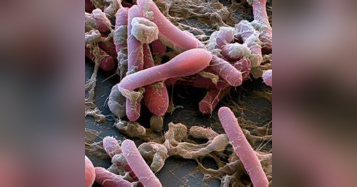 S5 E9: Paralysis on Purpose: The Story of Botulism S5 E9: Paralysis on Purpose: The Story of Botulism