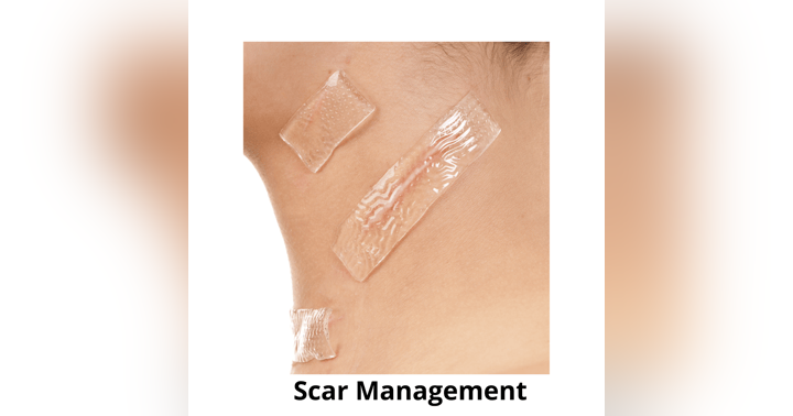 image for Scar Management with Dr. Brandyn Dunn