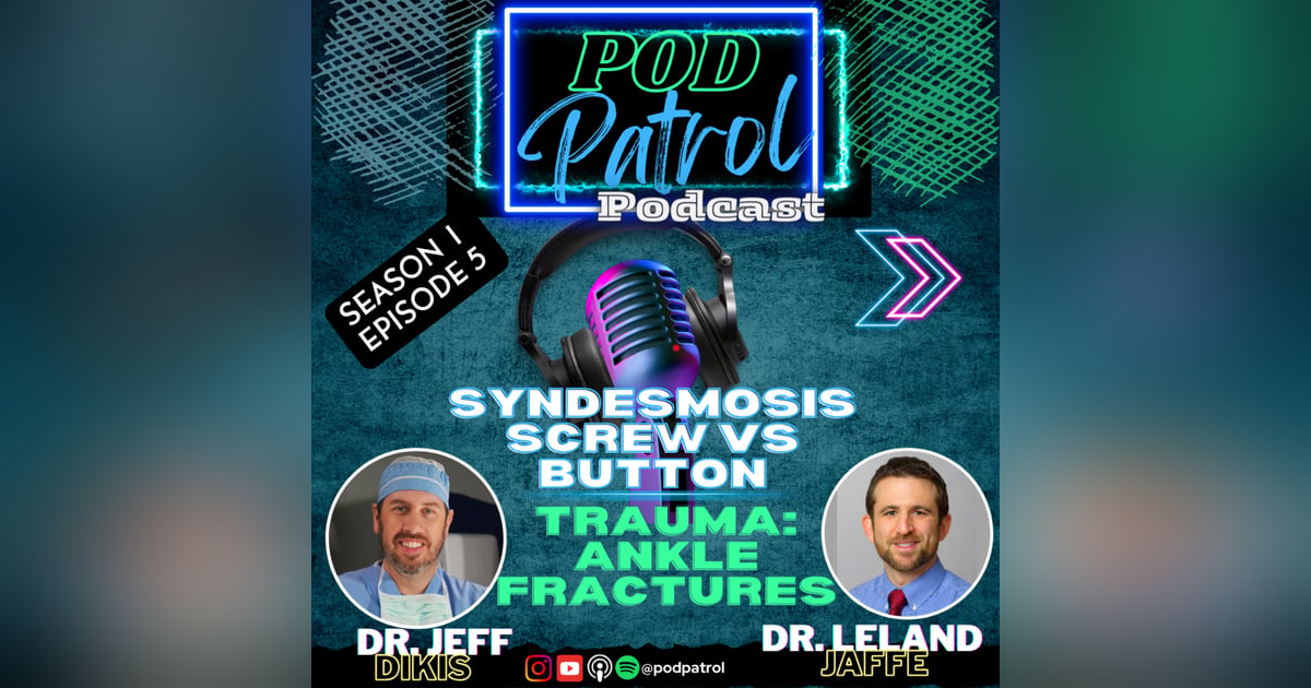 Pod Patrol Podcast S1.E5 - Ankle Fractures/ Syndesmosis Screws vs Suture Button Pod Patrol Podcast S1.E5 - Ankle Fractures/ Syndesmosis Screws vs Suture Button
