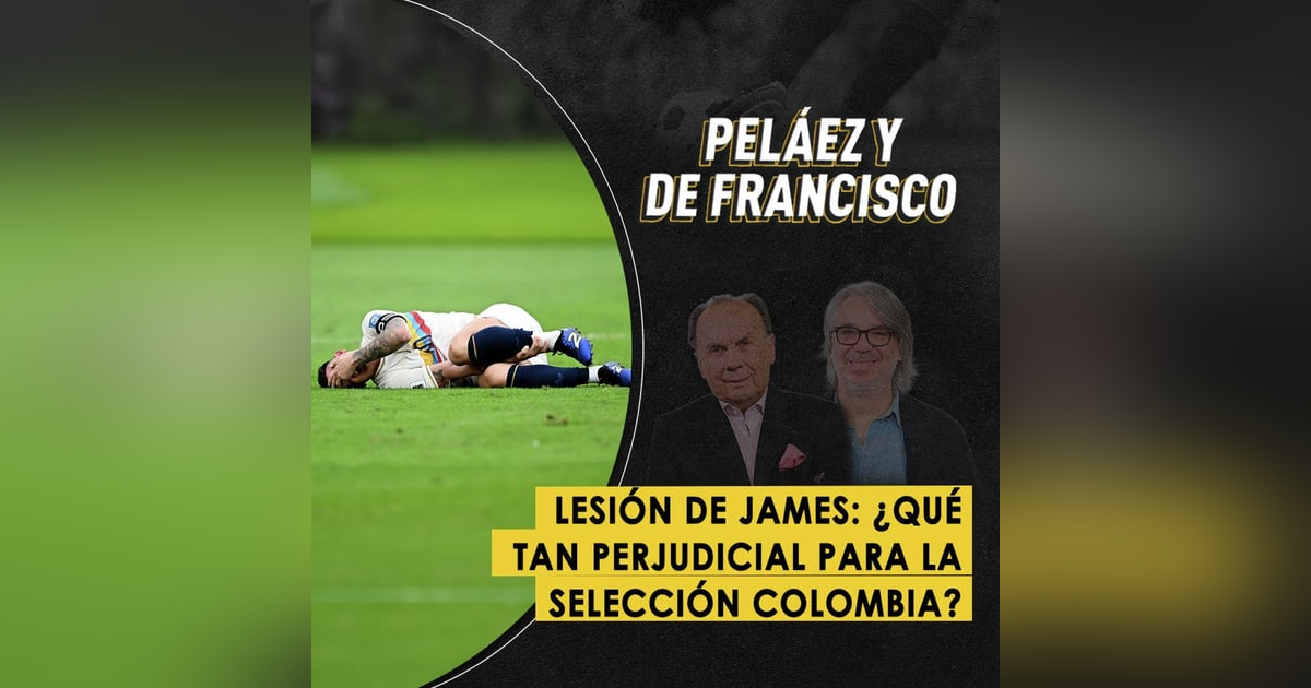 Lesión de James: ¿qué tan perjudicial para la Selección Colombia? Lesión de James: ¿qué tan perjudicial para la Selección Colombia?