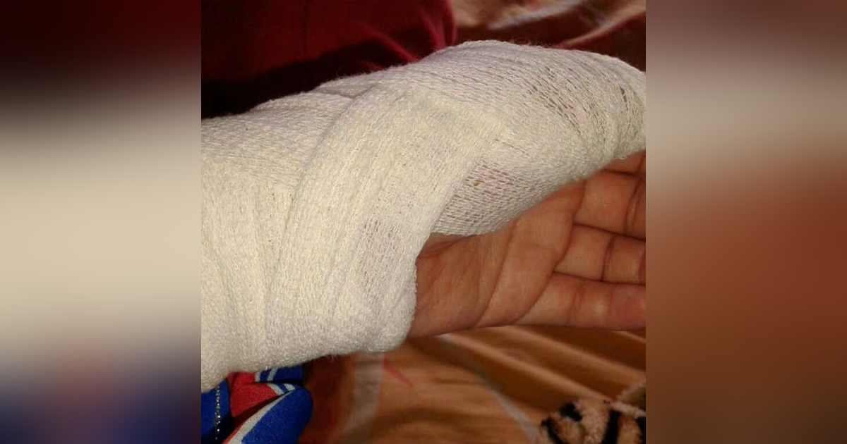 Historias de Miedo Octubre 2 de 2024 LA MORDIDA Historias de Miedo Octubre 2 de 2024 LA MORDIDA