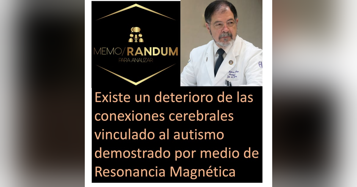 Existe un deterioro de las conexiones cerebrales vinculado al autismo demostrado por medio de Resonancia Magnética Existe un deterioro de las conexiones cerebrales vinculado al autismo demostrado por medio de Resonancia Magnética