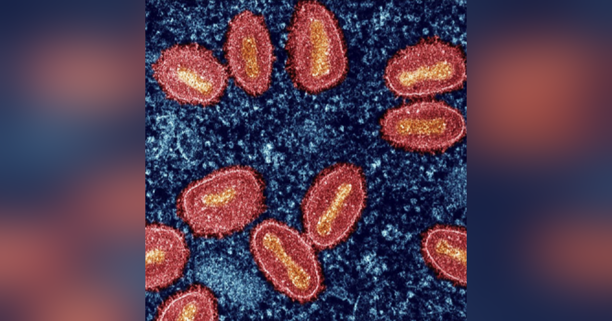 Mpox Outbreak in Sweden Raises Concerns of Wider Spread in Europe Mpox Outbreak in Sweden Raises Concerns of Wider Spread in Europe