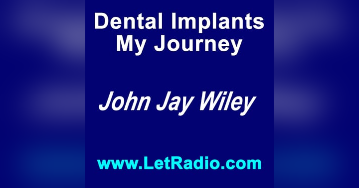 image for My Journey to Dental Implants: Part 3, Deciding To Move Forward.