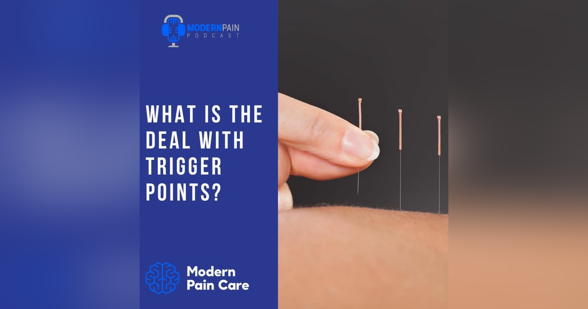 What Is The Deal With Trigger Points? What Is The Deal With Trigger Points?