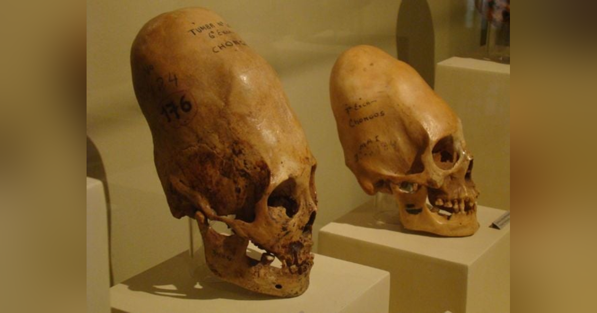 Insane Beauty Treatments Insane Beauty Treatments