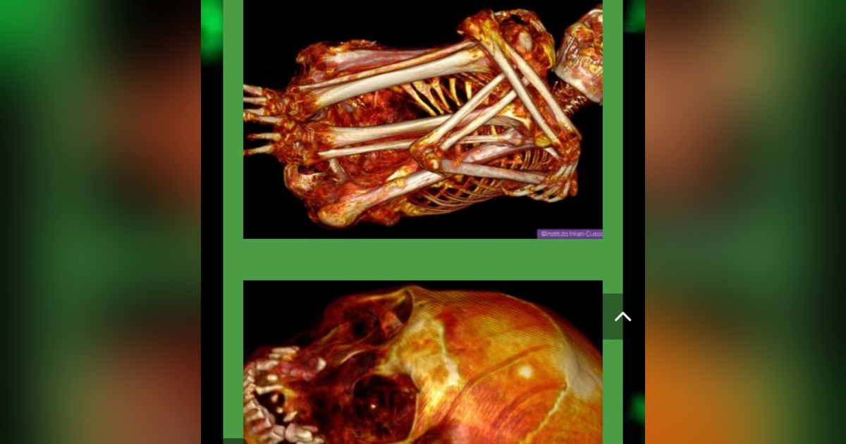 Peru Nazca Alien Mummies Confirmed Real in Mexico National Congress UFO Breifing Peru Nazca Alien Mummies Confirmed Real in Mexico National Congress UFO Breifing