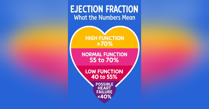 image for Ejection Fraction