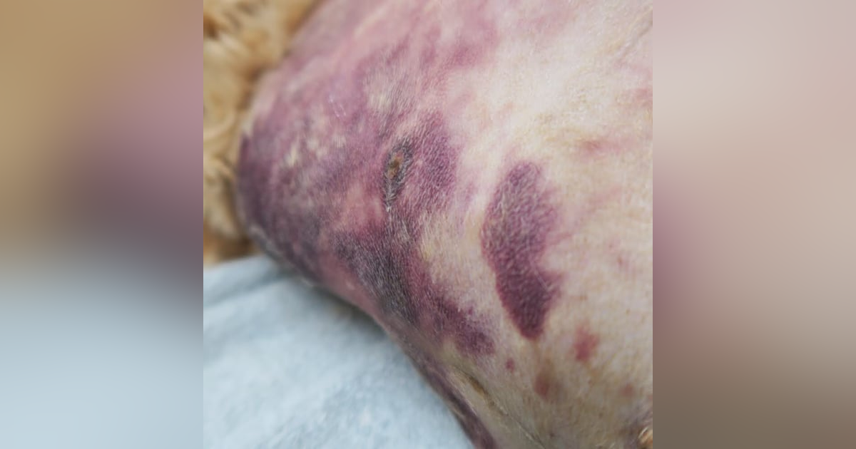 VV Clinical: A practical guide to diagnosing coagulopathy, Part 2. VV Clinical: A practical guide to diagnosing coagulopathy, Part 2.